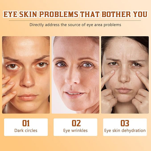 2Pcs Lumibalm For Under Eye Bags, Lumibalm Retinol Eye Serum, Deeply Moisturizes & Reduce Fine Lines (A)