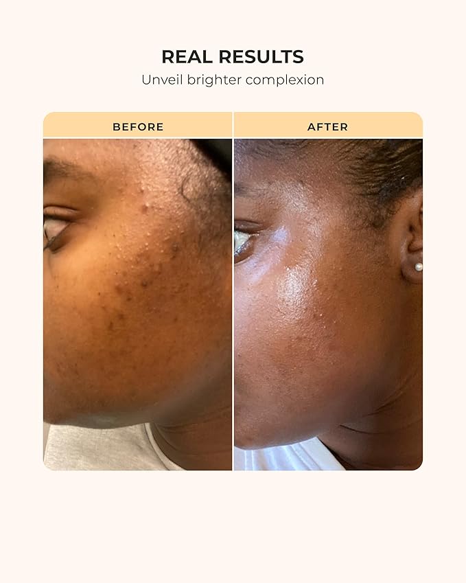 Buttah Skin Supreme Kit for Melanin Rich Skin | CocoShea Revitalizing Cream 2 oz | Vitamin C Serum 1 oz | Cleanser 3.4 oz | Rosewater Toner 3.4 oz | Black Owned Skincare