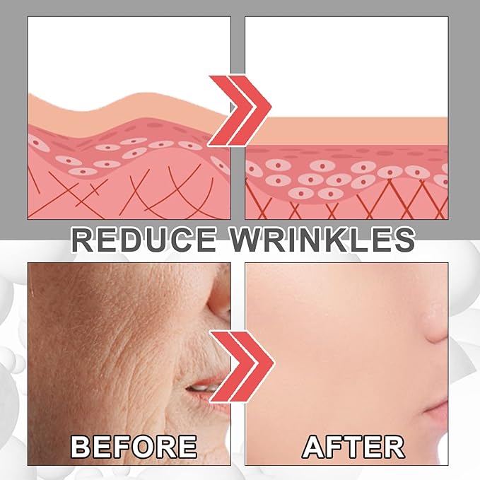 3Pcs EELHOE Collagen Boost Anti Aging Serum, EELHOE Collagen Anti-Wrinkle Cream, Voletas Collagen Boost Anti-Aging Serum