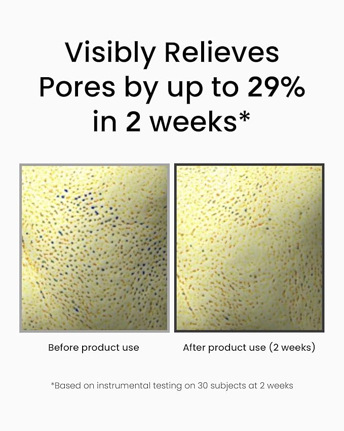 Advanced Korean Cream (1.76oz) + Retinol Serum (1fl oz) Hydration & Firming Skincare Duo with Niacinamide, Peptide, Vitamin C, TECA – Targets Fine Lines, Pigmentation & Elasticity