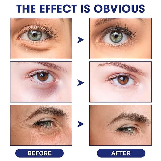 Sea Gril Anti Wrinkle Serum, Peg-8 Complex Anti Wrinkles Essence, Glozie Eye Serum, Anti Aging Firm Eye Cream, Glozie Instant Eye Lift Cream,Temporary Eye Tightener(2PCS)