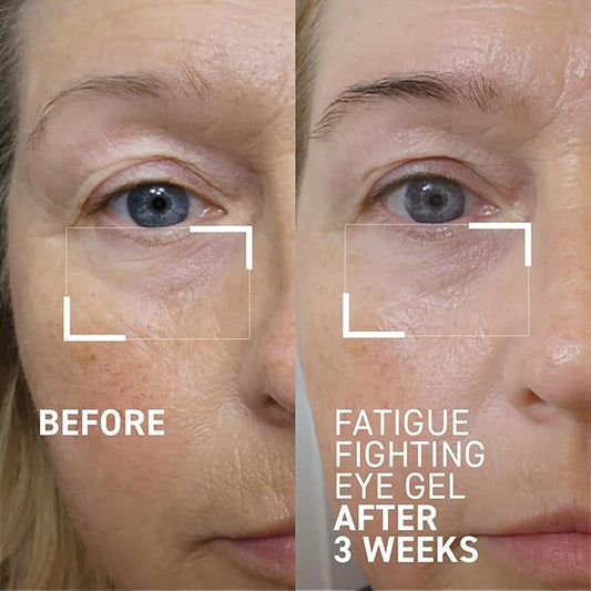 Dr. Brandt iD-STRESS Fatigue Fighting Eye Gel - 0.5 fl oz, Pack of 2 - Rapidly Diminishes Signs of Dryness, Fatigue & Dark Circles in the Eye Area