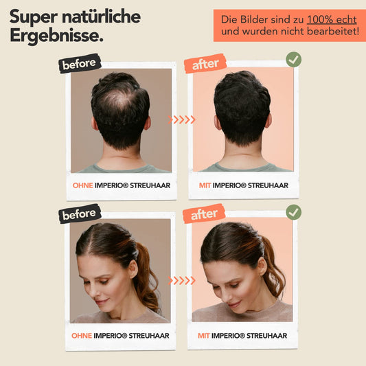 IMPERIO Hair Building Fibers for Thinning Hair - 26g Premium Hair Fibers for Women & Men in Hairdresser Quality - Hair thickening in less than 20 seconds (Medium Blonde)