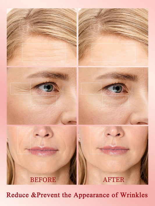 Radio Frequency Skin Tightening Device, Professional Wireless Home RF Skin Tightening Face Machine, 3 Levels for Smooth Fine Lines, Lifting, Firming