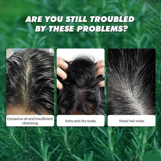 Scalp Scrub, Rosemary Mint Scalp Exfoliator Scrub with a Silicone Scalp Massager, Clarify and Remove Build Up, Deep Cleansing, Scalp Soothing, Reduce Oily Hair, Promotes Hair Growth