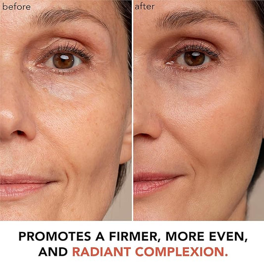 Beauty by Earth Vitamin C Face Cream - USA Made with Organic & Natural Ingredients, Skin Brightening Cream for Face, Discoloration Correcting & Anti Aging Moisturizer for Face with Antioxidants