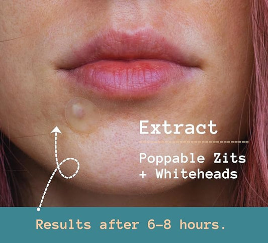 Korean Pimple Patches with Salicylic Acid - Invisible Pimple Patch - Hydrocolloid Acne Patch - Premium Zit sticker 48 Count 2 Sizes (10mm & 12mm)