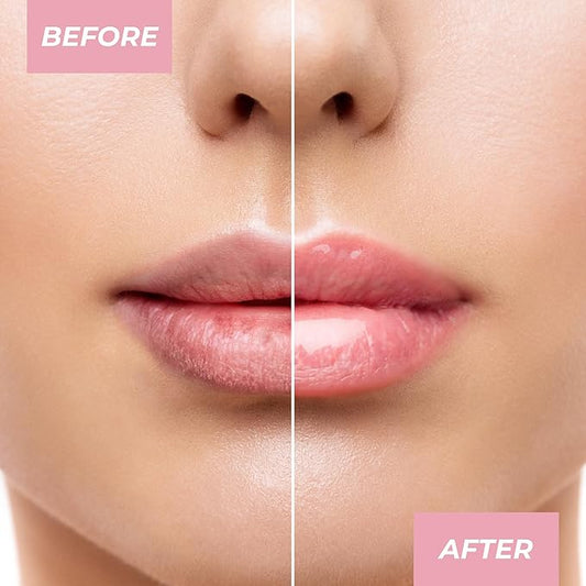 MCoBeauty Overnight Lip Mask - Deluxe Trio, Hydrating Lip Balm, Vegan, Cruelty Free Cosmetics