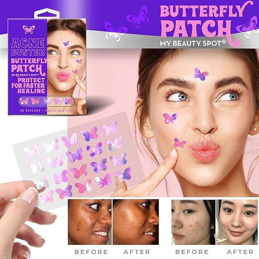 My Beauty Spot Pimple Patches Cute Acne Patches for Face 20 Pcs with Tea Tree Extra & Salicylic Acid, Butterfly and Rainbow Colorful Fun Designs – Pimple Patches for Face Acne Spot Treatment
