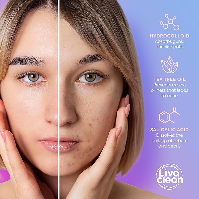 LivaClean 240 CT Cute Pimple Patches for Face w/Salicylic Acid & Tea Tree, Hydrocolloid Acne Patches Cute Flower Pimple Patch for Healing, Adorable Face Stickers, Zit Patch