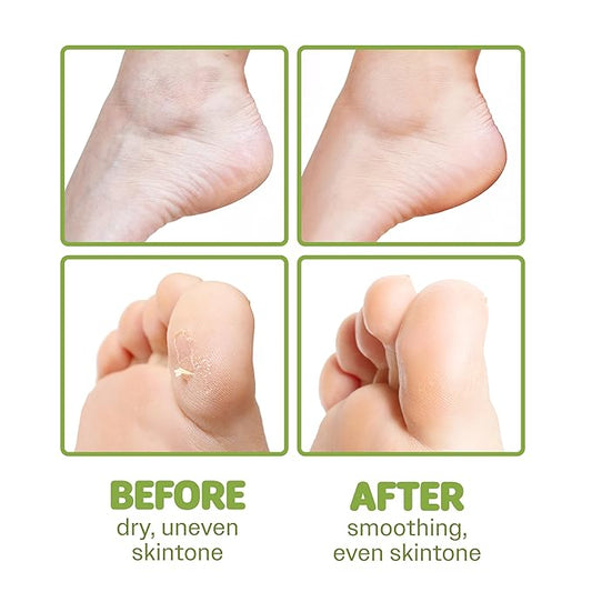 ONSOI 12PK Foot Masks for Soft, Smooth, Moisturizing Foot Mask for Dry Cracked Feet, Baby Feet - Coconut & Shea Butter (12PK Shea Butter)