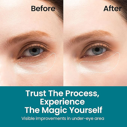 NURIVE's Youthful Skin & Bright Eyes Pack | Depuffs and Brightens Your Under Eye Bags | Helps Minimize Fine Lines and Wrinkles for Sensitive Skin