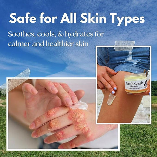 Cattle Creek Whipped Beef Tallow for Skin & Face – Deeply Moisturizing Tallow Balm – Organic Grass-Fed Skincare – Nourishes Dry, Sensitive Skin– Non-Comedogenic, Fast-Absorbing (4oz, Vanilla)