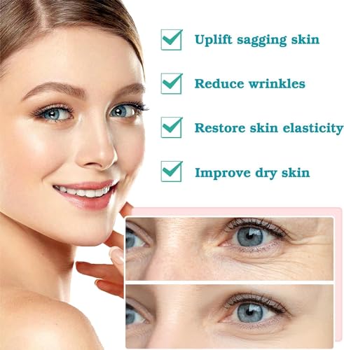 PCL Threads for Face Mono Screw Type 26G60MM PCL Threads for Face & Body Lift Smoothing of Wrinkles with Sharp Tips 20pcs Long Lasting Tighten Skin and Firming