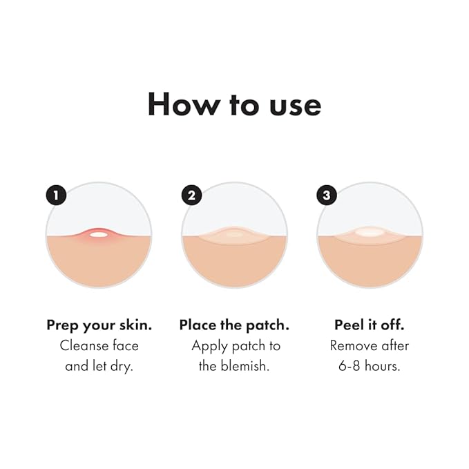 Mighty Patch™ Original Patch - Hydrocolloid Acne Pimple Patch for Covering Zits and Blemishes, Spot Stickers for Face and Skin (75 Count)