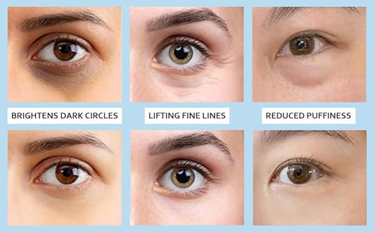 5% Caffeine Eye Serum, Anti-Aging Hydrating Eye Serum with 360° Massage Ball,Caffeine Eye Roller Reduce Wrinkles and Fine Lines,Under Eye Roller Cream for Dark Circles and Puffiness