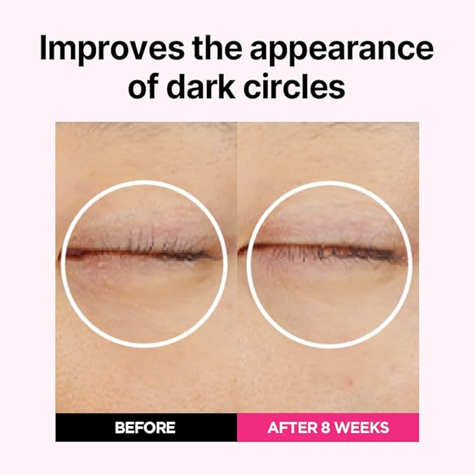 ISOI Blemish Care Up Serum Triple Set, Korean Skin Care for Glass Skin Radiance, Includes 2 Full Size & 1 Refill Serums, Eye & Wrinkle Patch Tester, Daily Hydration Gift Set (2.13 fl. oz)