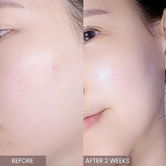 Pink Tea Tree Synergy Serum 30mL/Skin Moisturizer/Facial Moisturizers/1.01 Fl. Oz, CICA, Hyaluronic Acid and Niacinamide, Korean Skin Care, Hydrating