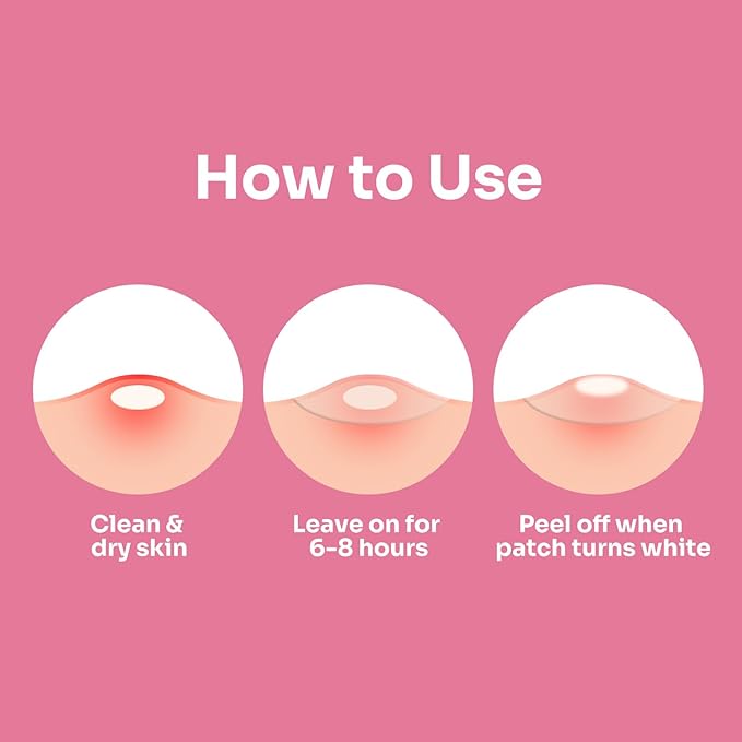 Conkote Hydrocolloid Acne Pimple Patches, 15mm Large Pimple Patches to Absorb Acne Secretions for Face and Skin, 45 Counts