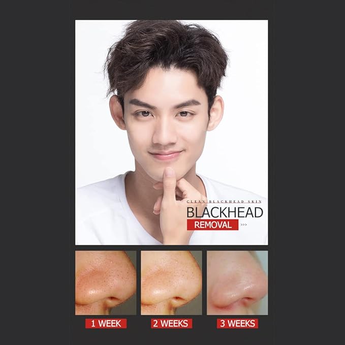 VENZEN Men's Cool Blackhead Removal Essence Nose Mask Pores Cleansing Water Kit 3pcs Set