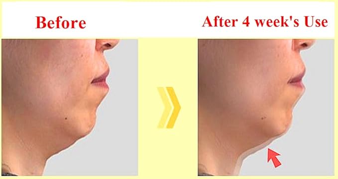 ULTIMATE (0.4%) Retinoid (liposome) Cream ┃Line Lifting and Rejuvenation Concentrate (30ml/1oz)