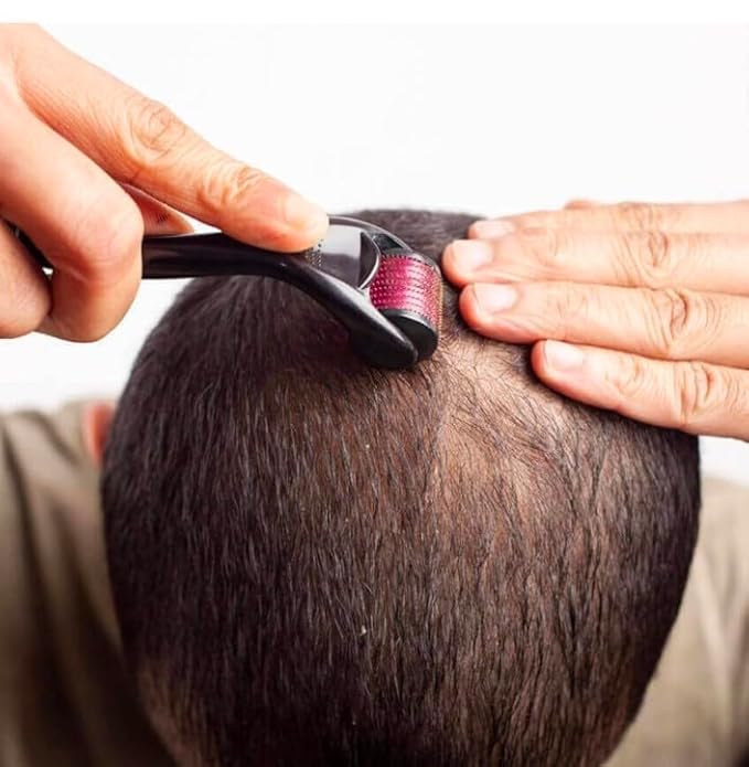 RadBizz Derma Roller and Storage Case - 0.25mm