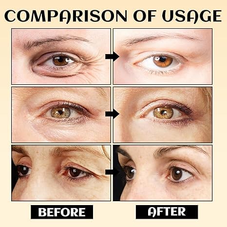 Eye Balm with Vitamin C Reduces Puffiness, 2025 New Revive Vitamin C Eye Balm Stick for Reducing Dark Circle, Hydrating Eyes Cream Eyes Care Stick for Women