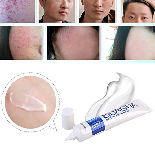 BIOAQUA 3in1 Face Acne Scar Removal Spots Oil Cream Scar Blemish Marks Moisturizing Oil 100g+30g+30ml
