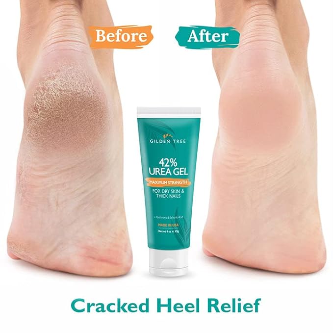 GILDEN TREE Urea Gel 42 Percent For Feet Maximum Strength Softens Cracked Heel Calluses & Thick Toenails