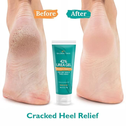GILDEN TREE Urea Gel 42 Percent For Feet Maximum Strength Softens Cracked Heel Calluses & Thick Toenails