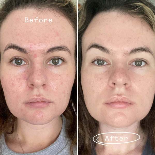 PAI SKINCARE - Organic Carbon Star Detoxifying Overnight Face Oil | Natural, Vegan, Sensitive Skincare (1 fl oz | 30 ml)