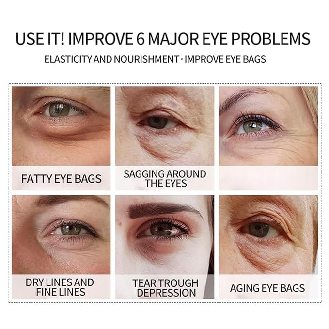 BLUE LOVE 2PC Astaxanthin Eye Serum - Reduces Dark Circles & Puffiness, Anti-Aging Formula Targets Wrinkles, Hydrating for Puffy Bags, Fast Absorbing & Moisturizing