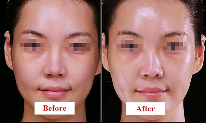 ULTIMATE [Human Stem Cell + (10%) PDRN] Healing Booster Overnight Serum―for Minimizes Wrinkles, Discoloration (10ml x 5vials)