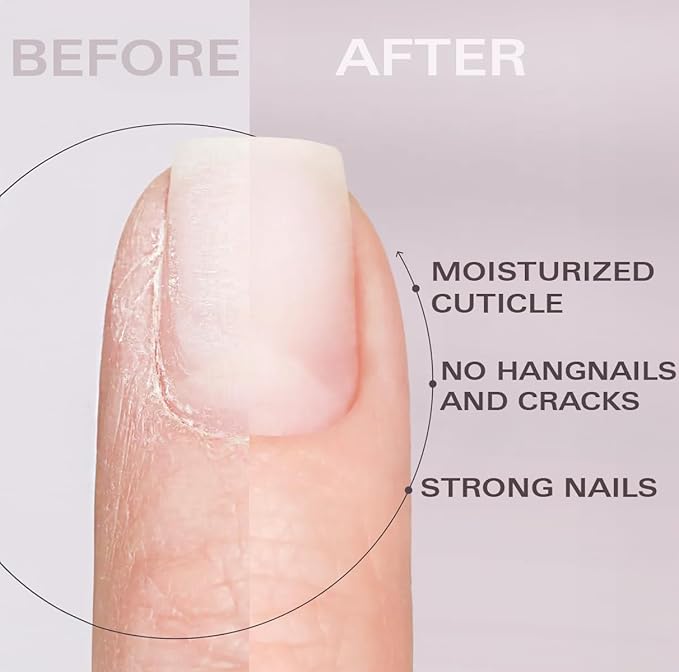 Nail Oil Cuticle Pen - Strawberry - Nail Strengthener & Growth Serum with Vitamin A, D, E, B5, Grapeseed & Natural Oils - Repair for Brittle, Peeling, Thin Nails - Twist Brush Pen