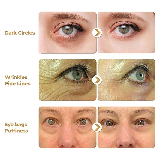 ABERA Natural Repair Eye Cream with Set 15 Eye Masks, Minimizes Under Eye Bags & Dark Circles, Reduce Puffiness, Wrinkles and Fine Lines, 0.5 fl oz