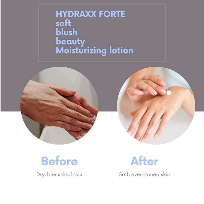 HYDRAXX FORTE Lotion for Daily Use - Moisturizing Lotion for Dry Skin – Non Greasy Hypoallergenic Body Lotion for All Skin Type | Fragrance-Free | Non-Comedogenic, 1 Fl Oz (Pack of 1)
