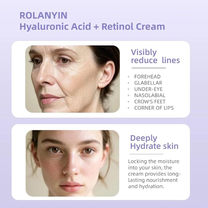 ROLANYIN Hyaluronic Acid + Retinol Cream Anti Aging and Deep Hydration Nourishing Wrinkle Reduction and Smoothing Formula for Improved Skin Texture Skin Care