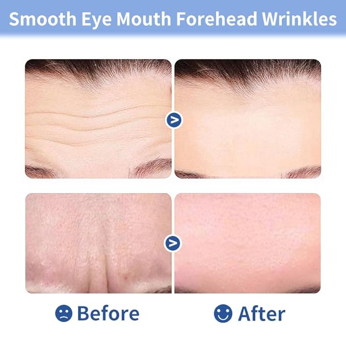 10pcs Masks | Collagen Forehead Anti-Wrinkle Treatments | Jelly Touch Mask | Skin-Friendly Hydrogel for Deep Hydration, Firming & Fine Line Reduction, Targets Forehead Wrinkles & Frown Lines