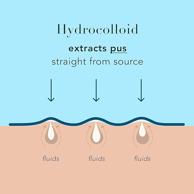 Rael Pimple Patches, Miracle XL Spot Control Cover - Hydrocolloid Acne Patch for Face, Zits & Blemish, Back and Body, Korean Skin Care, Vegan, Cruelty Free (6 Count)