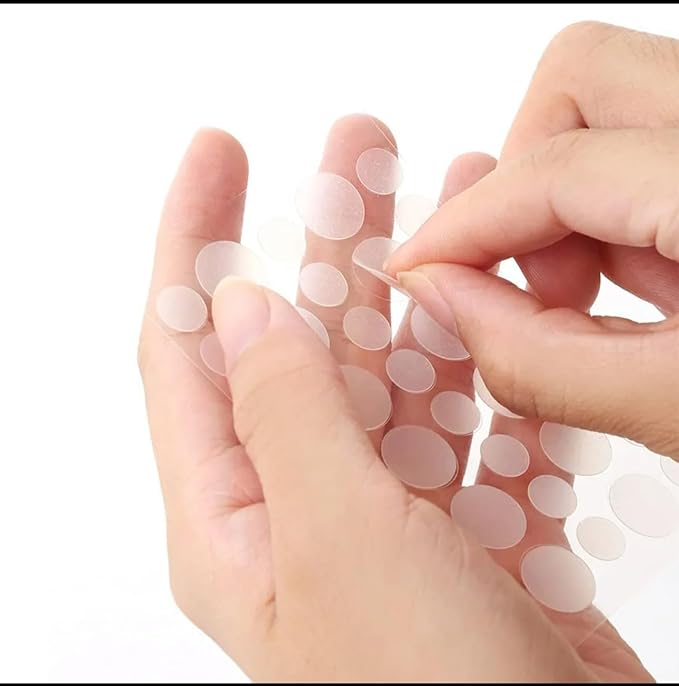 ZitZap Pimple/Acne Patches For Face And Skin, Hydrocolloid Patches With Salicylic Acid And Tea Tree Oil For Covering Zits And Blemishes.