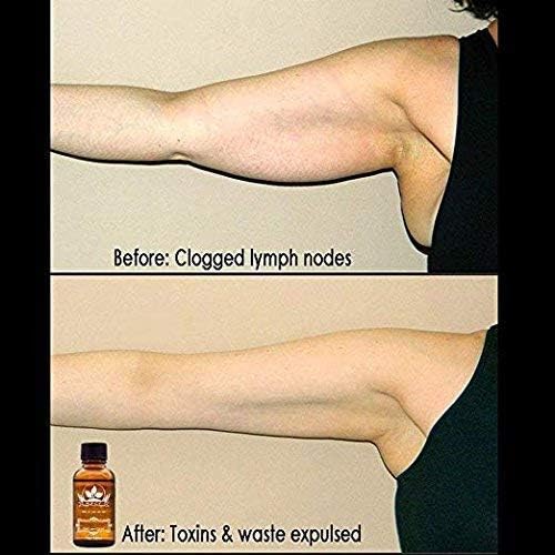 3 Pack Lymphatic Drainage Ginger Oil, Promote Blood Circulation Metabolism SPA Massage Oil.