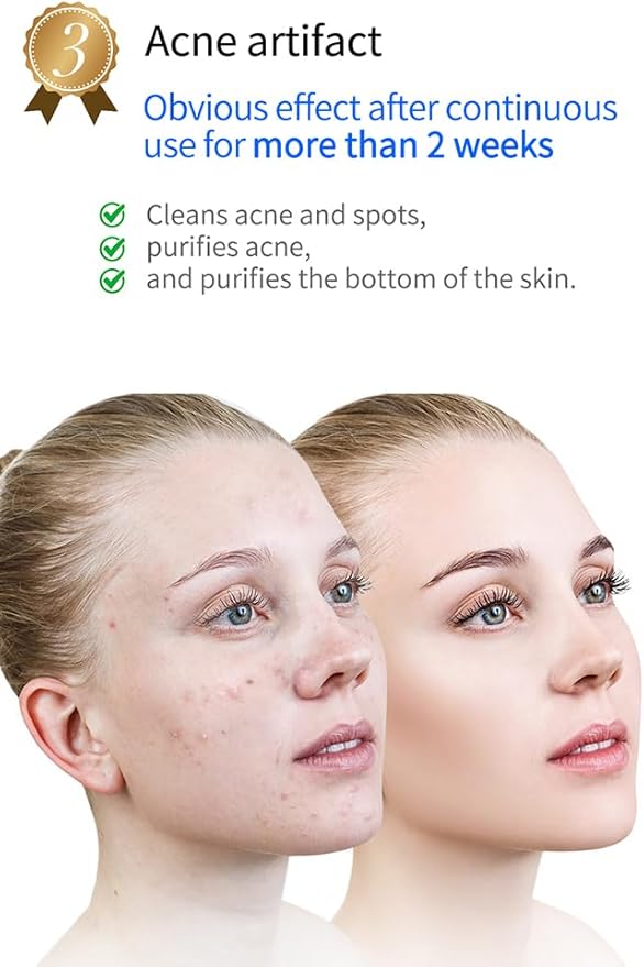 Plasma Facial Device, Ozone Skin Care Machine, Face Massager for Acne Treatment, Brightening, Anti-Wrinkle