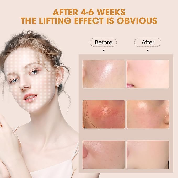 Blue Red Light Theràpy Màsk for Face, 7 Colors LED Light Theràpy, LED Portable Facial Skin Care Màsk for Face and Neck