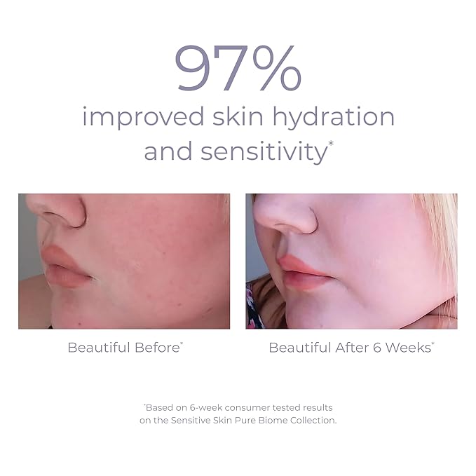 Derma E Pure Biome Balancing Cleanser- For Sensitive Skin Fragrance-Free, 6oz