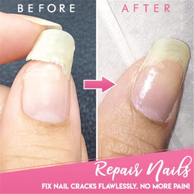 5ml Instant Cracked Nail Repair Gel, Strengthener, Phototherapy Glue - Recovery for Restore Weak, Broken, Damaged Nails - Instantly Fill in and Fix Cracks Flawlessly (1pc)