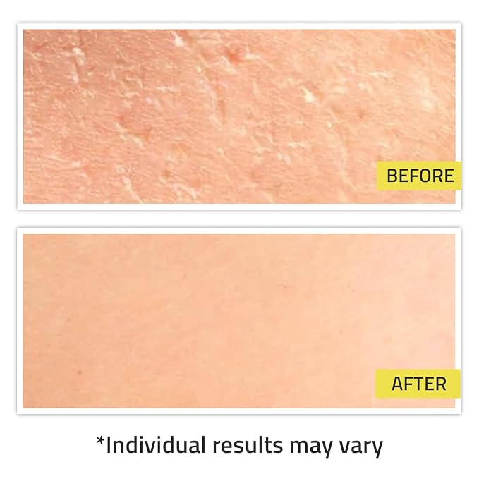 YEOUTH Snail Mucin Serum for Face, Hydrating Advanced Snail 96 Mucin Power Essence, Face Serum with Hyaluronic Acid, Lightweight, Fast-Absorbing & Non-Sticky 1oz