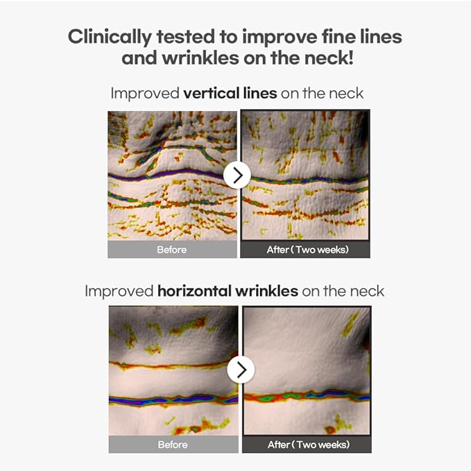 Avajar Rejuvenating Neck Wrinkle Control Mask (5P) – Advanced K-Beauty Wrinkle & Fine Lines Patches with Collagen and PDRN, Anti-Aging Tightening Korean Skincare Neck Cream for Smoother, Firmer Skin