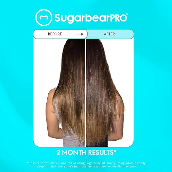 Sugarbear Batana Hair Oil & Glass-Dropper Applicator, 1oz + Vegan Hair Vitamin Gummies 1 Month Supply, Extra Strength Biotin 6000mcg