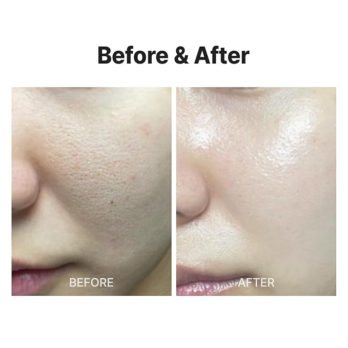 MEDITHERAPY Wrinkle fit Korean Mesh Sheet Masks (7EA), Collagen Mesh Sheet Mask for Glowing Skin, Daily Facial Mask, Hyaluronic acid Facial Mask, Korean Skincare