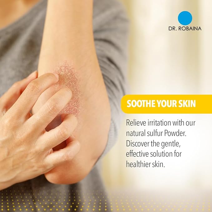 Dr. Robaina Sulfur Balsam Lotion – Daily Moisturizing Lotion for Eczema and Psoriasis Relief – Soothes Redness, Hydrates Sensitive Skin – Natural Ingredients – Made in the USA (Pack of 2)